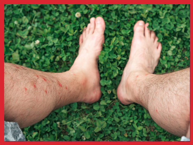 ślady ukąszeń owadów mrówki
